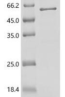 Mouse Fasciculation and elongation protein zeta-2 (Fez2) Recombinant Protein - BioCrest Sci