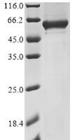Human SH2B adapter protein 1 (SH2B1) (T484A,V541A), partial Recombinant Protein - BioCrest Sci
