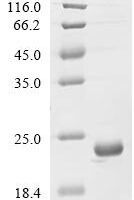 Acyrthosiphon pisum Odorant-binding protein 7 (obp7) Recombinant Protein - BioCrest Sci
