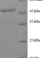 Human Proteasome subunit beta type-2 (PSMB2) Recombinant Protein - BioCrest Sci