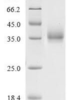 Pig tissue kallikrein (KLK5), partial Recombinant Protein, C-10His - BioCrest Sci