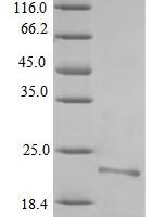 Yersinia pestis F1 capsule antigen (caf1) Recombinant Protein - BioCrest Sci