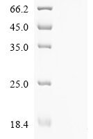 Adeno-associated virus 2 Protein Rep78 (Rep78) Recombinant Protein, N-MBP/C-His - BioCrest Sci