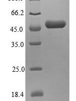 Human Eukaryotic translation initiation factor 3 subunit K (EIF3K) Recombinant Protein - BioCrest Sci