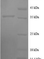 Human C-C motif chemokine 7 (CCL7) Recombinant Protein, N-GST - BioCrest Sci