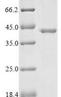 Bovine Pregnancy-associated glycoprotein 1 Recombinant Protein, C-Myc/C-His - BioCrest Sci