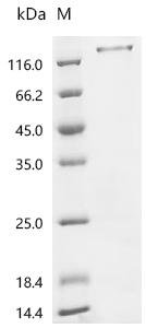 Mouse Mucin-1 (Muc1),partial Recombinant Protein, Mus musculus (Mouse), Yeast, C-terminal 6xHis-tagged, 52.9 kDa, purity >≥ 90% as determined by SDS-PAGE.