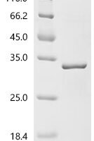 Human Akirin-2 (AKIRIN2) Recombinant Protein - BioCrest Sci
