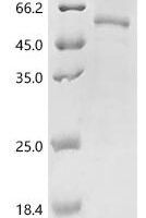 Mouse RNA-binding protein Nova-1 (Nova1) Recombinant Protein - BioCrest Sci