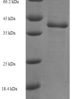 Saccharomyces cerevisiae GTP-binding protein YPT1 (YPT1) Recombinant Protein, N-His-SUMO - BioCrest Sci
