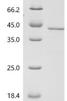 Mouse Zinc-alpha-2-glycoprotein (Azgp1) Recombinant Protein, C-His - BioCrest Sci