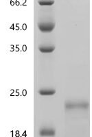 Human Solute carrier organic anion transporter family member 1A2 (SLCO1A2), partial Recombinant Protein - BioCrest Sci