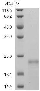 Human Solute carrier organic anion transporter family member 1A2 (SLCO1A2), partial Recombinant Protein, Homo sapiens (Human), E.coli, C-terminal 6xHis-tagged, 18.4 kDa, purity >≥ 90% as determined by SDS-PAGE.