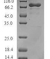 Human Arf-GAP with dual PH domain-containing protein 1 (ADAP1) Recombinant Protein, N-GST - BioCrest Sci