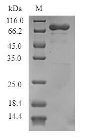 Human Arf-GAP with dual PH domain-containing protein 1 (ADAP1) Recombinant Protein, N-GST, Homo sapiens (Human), E.coli, N-terminal GST-tagged, 70.4 kDa, purity >≥ 90% as determined by SDS-PAGE.