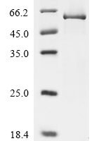 Human Transcriptional enhancer factor TEF-1(TEAD1) Recombinant Protein - BioCrest Sci