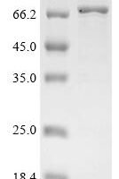 Human Butyrophilin-like protein 3 (BTNL3), partial,Biotinylated Recombinant Protein - BioCrest Sci