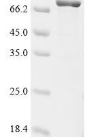 Rat CCN family member 4 (Ccn4), Biotinylated Recombinant Protein - BioCrest Sci