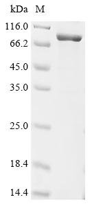 Rat CCN family member 4 (Ccn4), Biotinylated Recombinant Protein, Rattus norvegicus (Rat), E.coli, N-terminal MBP-tagged and C-terminal 6xHis-Avi-tagged, 86.0 kDa, purity >≥ 85% as determined by SDS-PAGE.