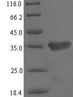 Mouse Vomeronasal secretory protein 1 (Lcn3) Recombinant Protein - BioCrest Sci