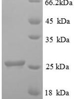 Human Ubiquitin-conjugating enzyme E2 K (UBE2K) Recombinant Protein - BioCrest Sci
