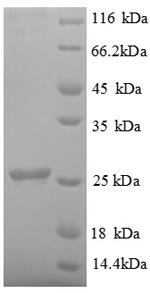 Human Ubiquitin-conjugating enzyme E2 K (UBE2K) Recombinant Protein, Homo sapiens (Human), E.coli, N-terminal 6xHis-tagged, 26.3 kDa, purity >≥ 90% as determined by SDS-PAGE.