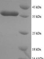 Human Dynein light chain 1, cytoplasmic (DYNLL1) Recombinant Protein - BioCrest Sci