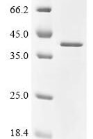 Human Ribonuclease H1 (RNASEH1) Recombinant Protein - BioCrest Sci