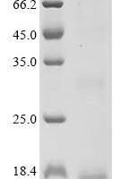 Human Cysteine-rich secretory protein 3 (CRISP3), partial Recombinant Protein - BioCrest Sci