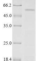 Human Receptor-type tyrosine-protein phosphatase-like N (PTPRN), partial Recombinant Protein, C-Myc/C-His - BioCrest Sci