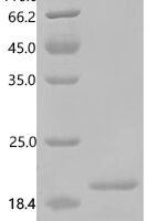 Human Ragulator complex protein LAMTOR5 (LAMTOR5) Recombinant Protein - BioCrest Sci