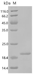 Human Ragulator complex protein LAMTOR5 (LAMTOR5) Recombinant Protein, Homo sapiens (Human), E.coli, C-terminal 6xHis-tagged, 15.6 kDa, purity >≥ 95% as determined by SDS-PAGE.