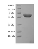 Human Uncharacterized protein C20orf197 (C20orf197) Recombinant Protein - BioCrest Sci
