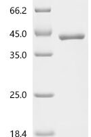 Human Prothrombin (F2),partial Recombinant Protein - BioCrest Sci