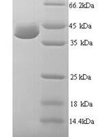 Human UV excision repair protein RAD23 homolog A (RAD23A) Recombinant Protein - BioCrest Sci