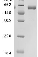 Human Heparan-sulfate 6-O-sulfotransferase 1 (HS6ST1), partial, Biotinylated Recombinant Protein - BioCrest Sci