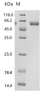 Human Heparan-sulfate 6-O-sulfotransferase 1 (HS6ST1), partial, Biotinylated Recombinant Protein, Homo sapiens (Human), Mammalian cell, C-terminal 10xHis-Avi-tagged, 48.9 kDa, purity >≥ 95% as determined by SDS-PAGE.