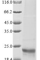 Culex quinquefasciatus Submitted name: Odorant binding protein OBP28 (6050687) Recombinant Protein - BioCrest Sci