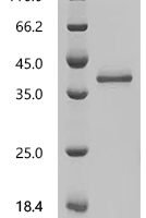 Sesamum indicum 2S albumin(LOC105174067) Recombinant Protein, N-His-SUMOstar - BioCrest Sci