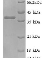 Human Nephrocystin-1 (NPHP1), partial Recombinant Protein - BioCrest Sci