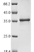 Human Heat shock protein HSP 90-alpha (HSP90AA1), partial Recombinant Protein, N-His, aa 292–559 - BioCrest Sci