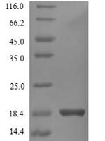 Human Interferon gamma (IFNG) Recombinant Protein, N-His, aa 24–161, Yeast - BioCrest Sci
