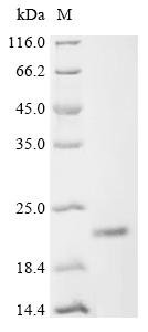Human Cysteine-rich hydrophobic domain 2 protein (CHIC2) Recombinant Protein, C-His, Homo sapiens (Human), E.coli, C-terminal 6xHis-tagged, 27.0 kDa, purity >≥ 90% as determined by SDS-PAGE.