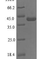 Human SH3 domain-containing YSC84-like protein 1 (SH3YL1) Recombinant Protein, N-His - BioCrest Sci