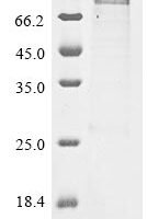 Human Protein-arginine deiminase type-2 (PADI2) Recombinant Protein, N-10His/C-Myc - BioCrest Sci