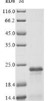 Human FXYD domain-containing ion transport regulator 3 (FXYD3),Partial Recombinant Protein - BioCrest Sci