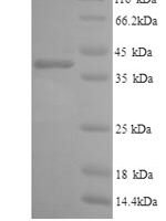 Human Interleukin-6 receptor subunit alpha (IL6R), partial Recombinant Protein - BioCrest Sci