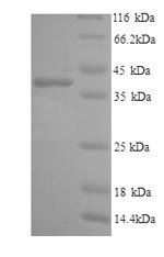 Human Interleukin-6 receptor subunit alpha (IL6R), partial Recombinant Protein, Homo sapiens (Human), Yeast, N-terminal 6xHis-tagged, 40.5 kDa, purity >≥ 90% as determined by SDS-PAGE.