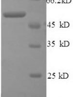 Human Cathepsin B (CTSB), partial Recombinant Protein - BioCrest Sci