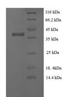 Rabies virus Phosphoprotein (P) Recombinant Protein - BioCrest Sci